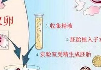 昆明正规医院试管费用是多少？昆明正规试管机构有哪些？