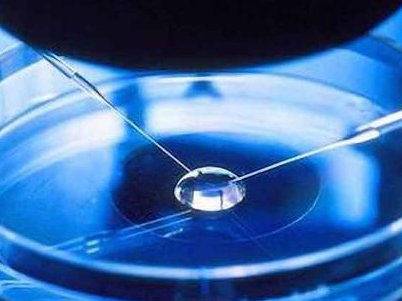 无锡正规试管婴儿助孕机构有哪些？如何避免试管婴儿的风险？